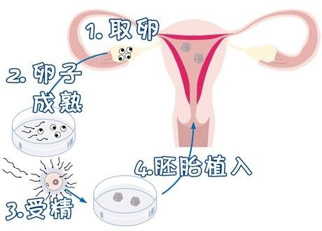中医妇科